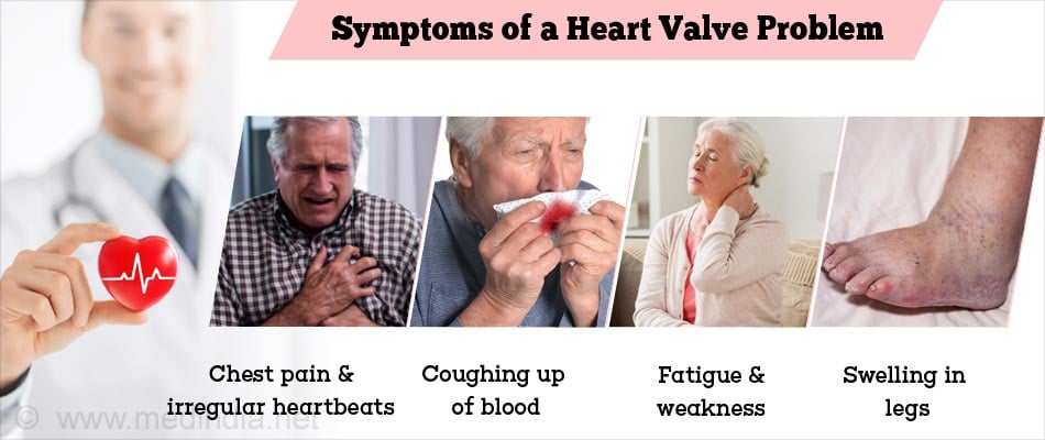 heart valve disease symptoms