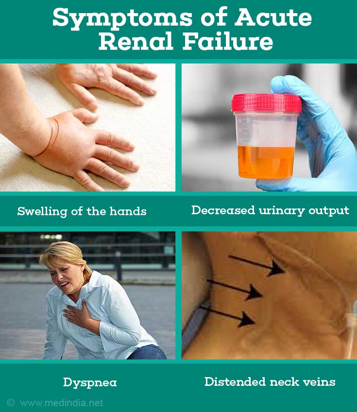 Acute Renal Kidney Failure Causes Symptoms Diagnosis Treatment