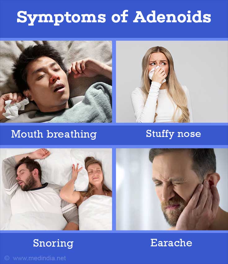 What Are Adenoids