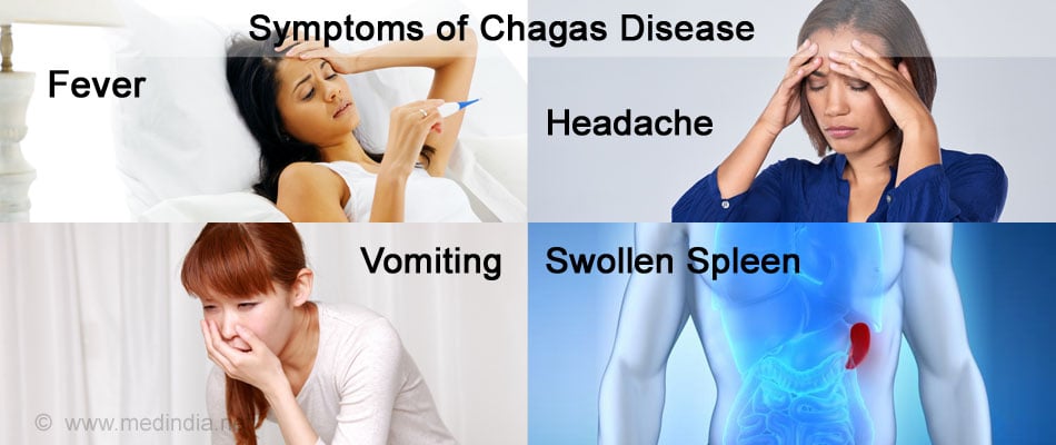 Chagas Disease - Causes, Symptoms, Diagnosis, Treatment & Prevention