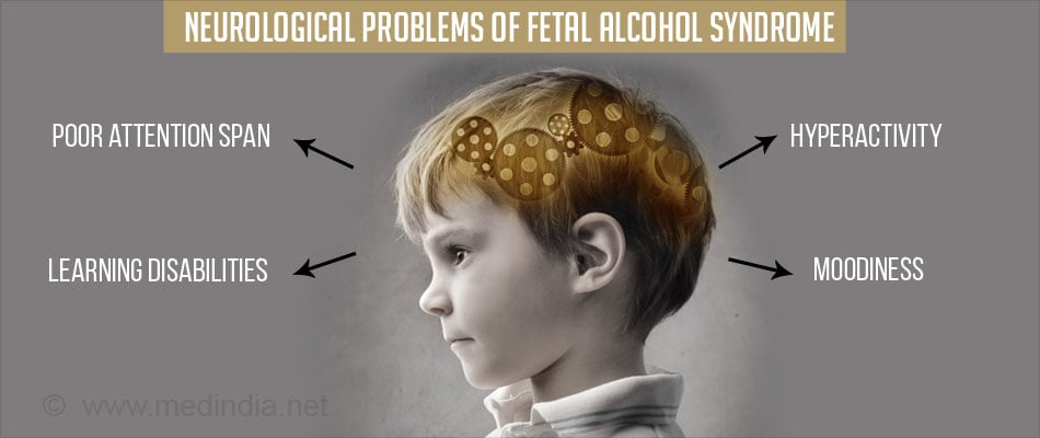Of syndrome alcohol symptoms fetal