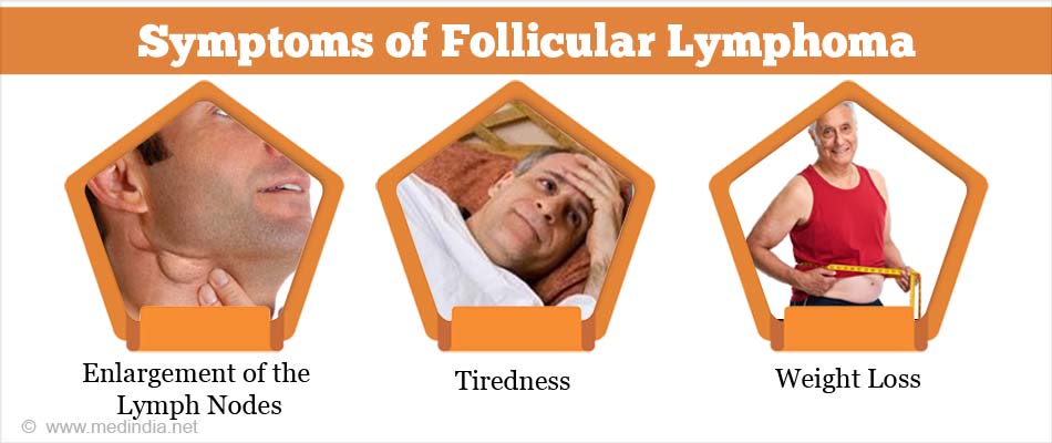 Follicular Lymphoma Causes Symptoms Diagnosis Treatment And Prevention