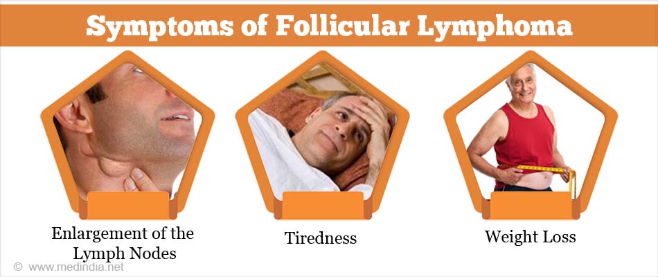 Follicular Lymphoma Causes Symptoms Diagnosis Treatment And Prevention 0810