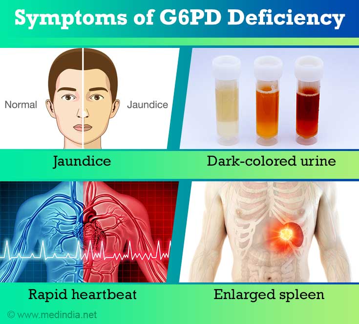 Glucose6phosphate Dehydrogenase Deficiency