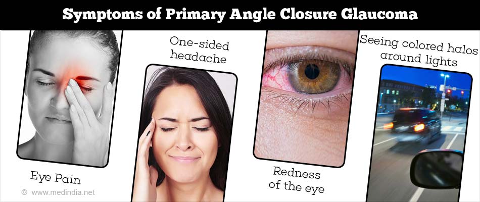 Symptoms of Glaucoma Symptoms of Glaucoma