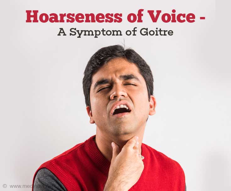 Symptoms of Goitre - Hoarseness of Voice Symptoms of Goitre - Hoarseness of Voice
