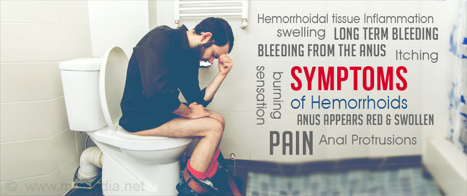 Symptoms of Hemorrhoids Symptoms of Hemorrhoids