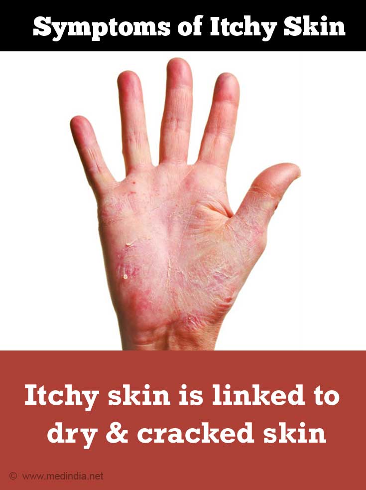 Itchy Skin Pruritus Causes Symptoms Diagnosis Treatment