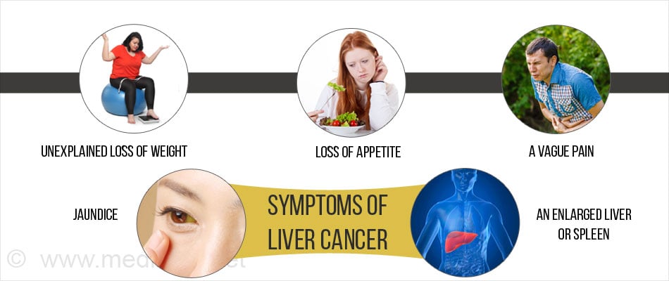 liver cancer symptoms