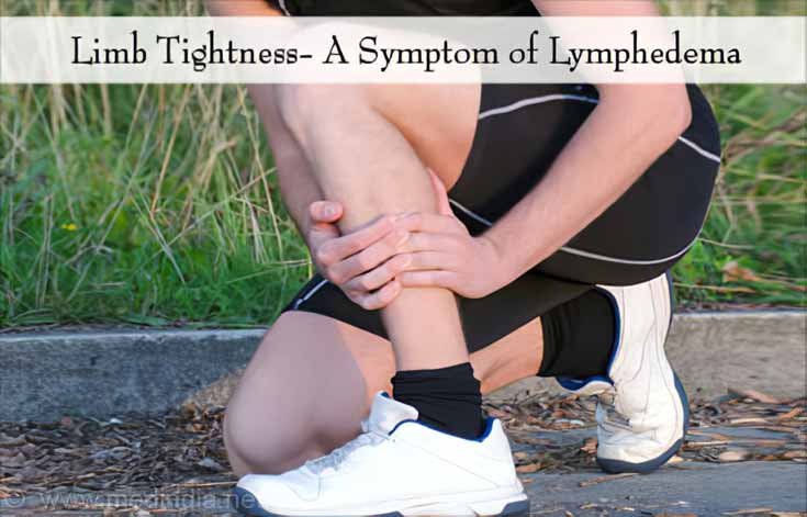 Symptoms of Lymphedema – Limb Tightness Symptoms of Lymphedema – Limb Tightness