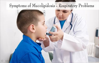 Symptoms of Mucolipidoses Symptoms of Mucolipidoses