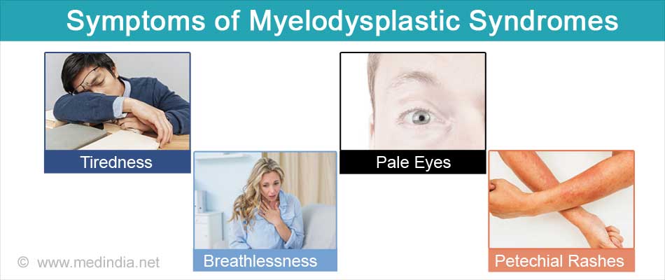 myelodysplastic syndrome