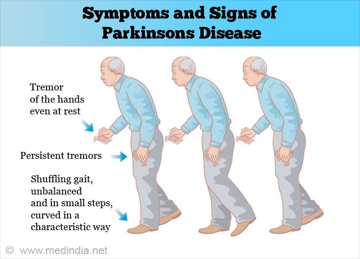 What Is Parkinsons Disease Causes Signs Symptoms And Treatments Images 
