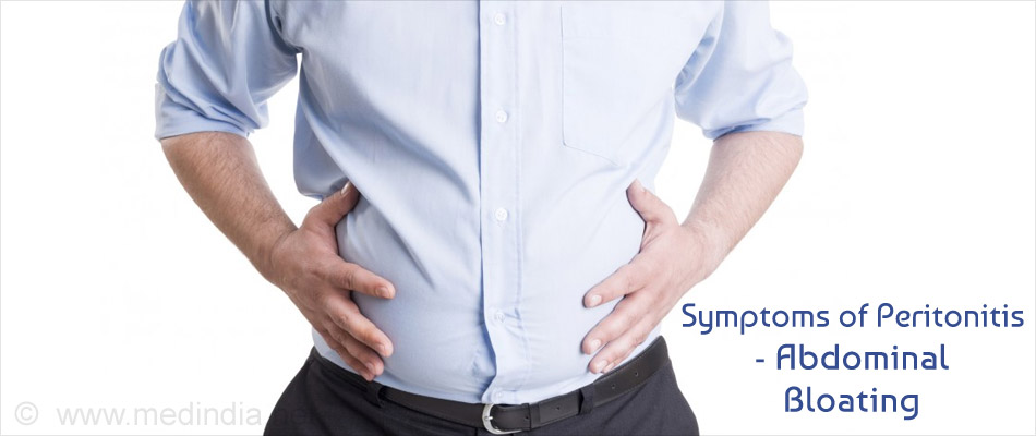 Symptom of Peritonitis - Abdominal Bloating Symptom of Peritonitis - Abdominal Bloating