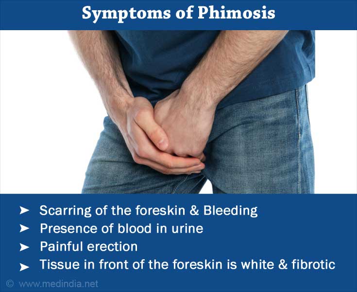 Phimosis : Causes and factors that lead to tight foreskin