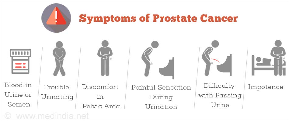 symptoms of prostate cancer a térd duzzanata nem múlik el