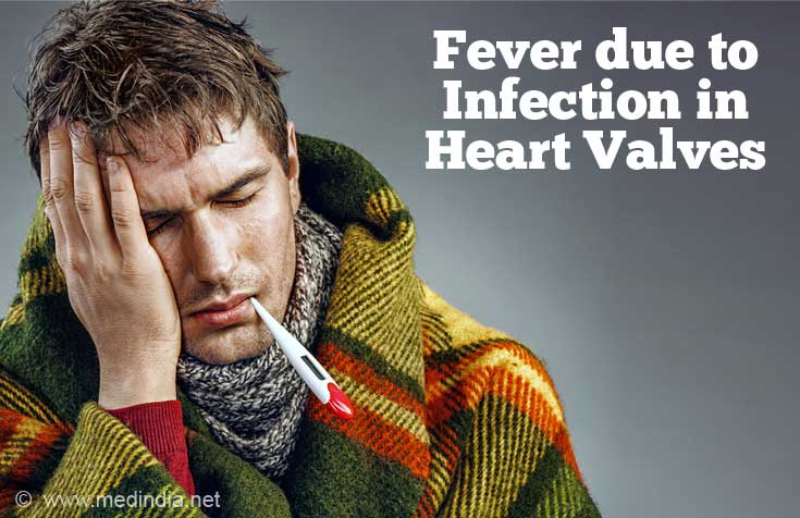 Symptoms of Rheumatic Heart Disease Symptoms of Rheumatic Heart Disease