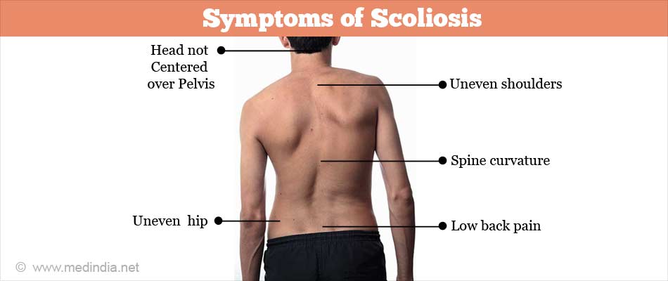 scoliosis thin man on his back no shirt. curvature of the spine