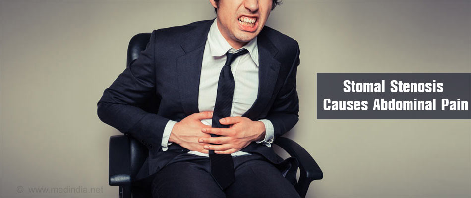 Symptoms of Stomal Stenosis Abdominal Pain Symptoms of Stomal Stenosis Abdominal Pain