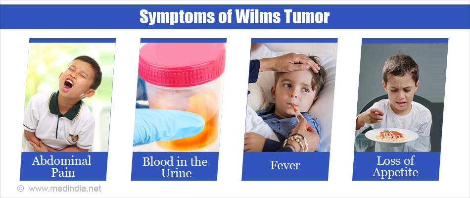 Wilms Tumor - Causes, Symptoms, Diagnosis, Treatment & Prevention