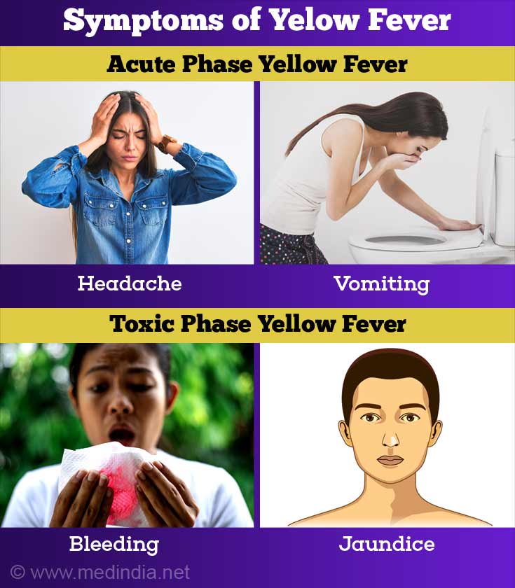 Yellow Fever | Acute Viral Hemorrhagic Fever - Causes, Symptoms ...