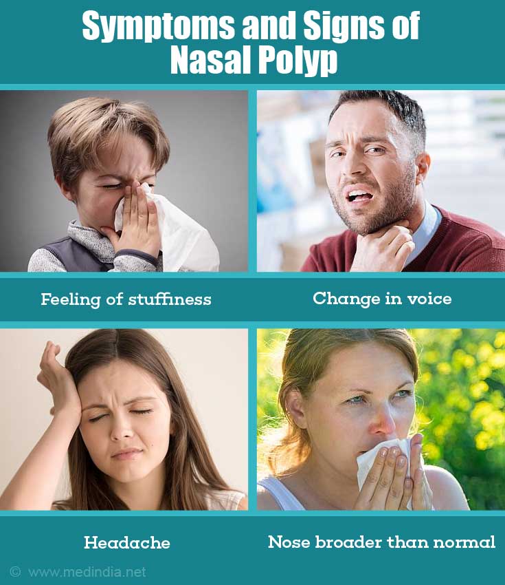 Nasal Polyp - Causes, Symptoms, Diagnosis, Treatment, Health Tips