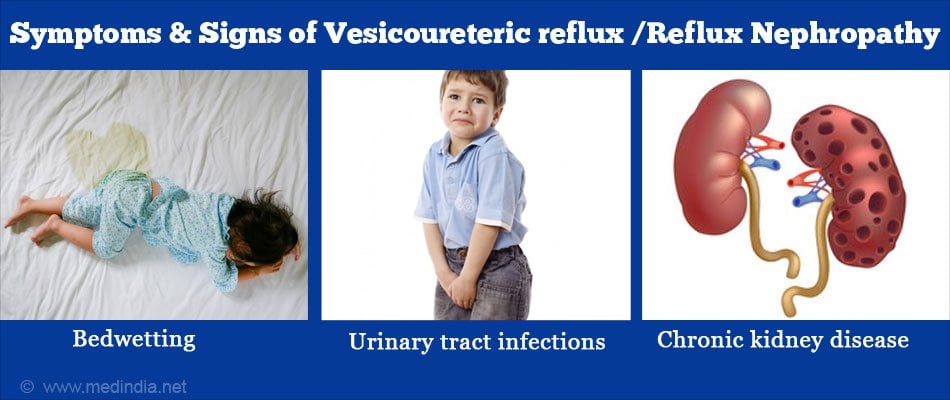 vesicoureteric-reflux-and-reflux-nephropathy-causes-symptoms