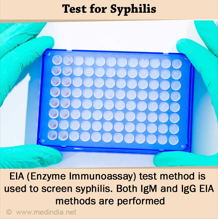 Syphilis Tests and Diagnosis