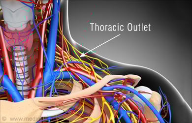 Thoracic Outlet Syndrome Thoracic Outlet Syndrome