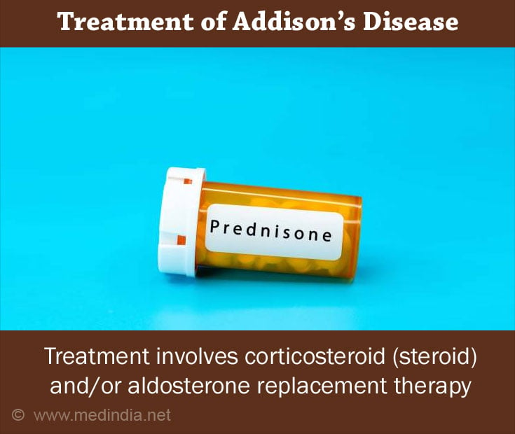 Treatment of Addison's Disease