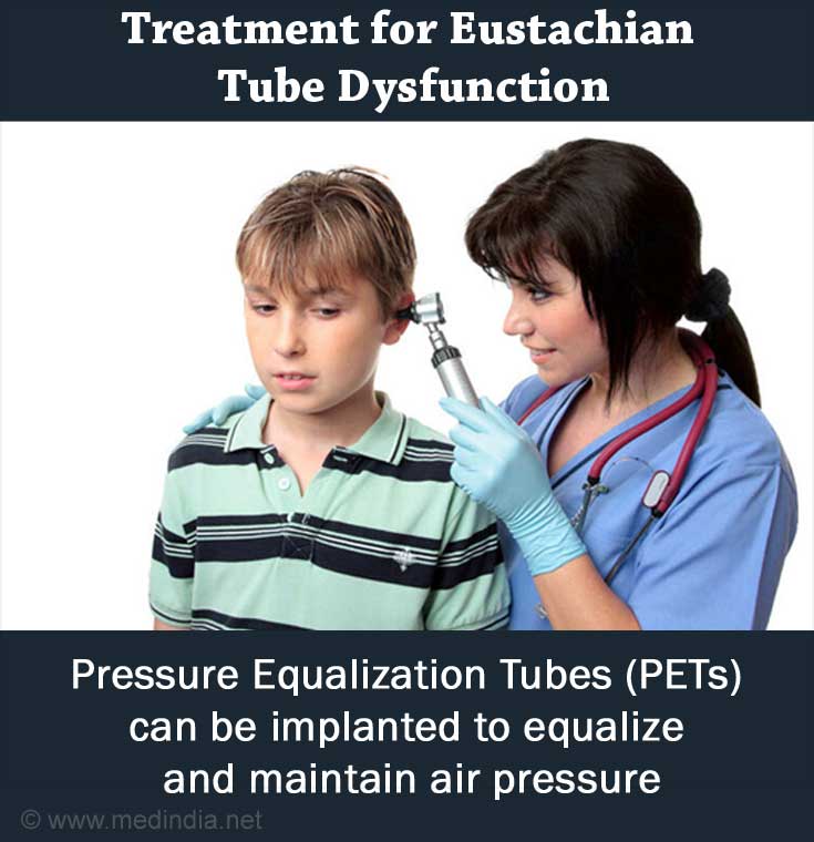 Eustachian Tube Dysfunction Causes, Symptoms, Diagnosis, Treatment