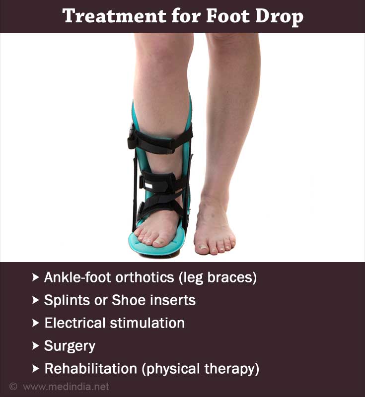 How to Treat Foot Drop with Electrical Stimulation Therapy