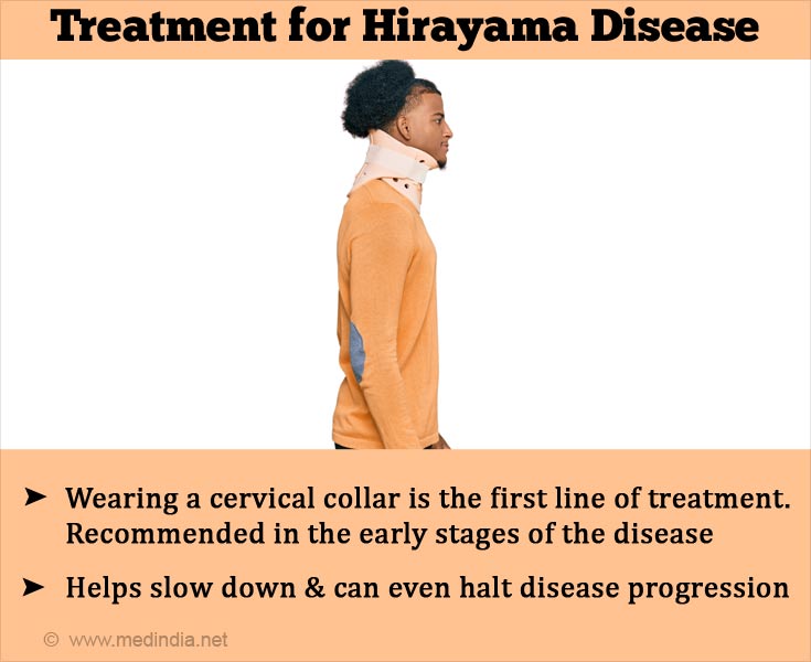 Treatment for Hirayama Disease Treatment for Hirayama Disease