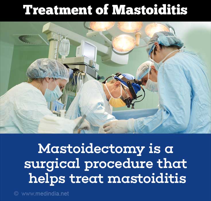 Mastoiditis Causes Symptoms Diagnosis Complications And Treatment 6297