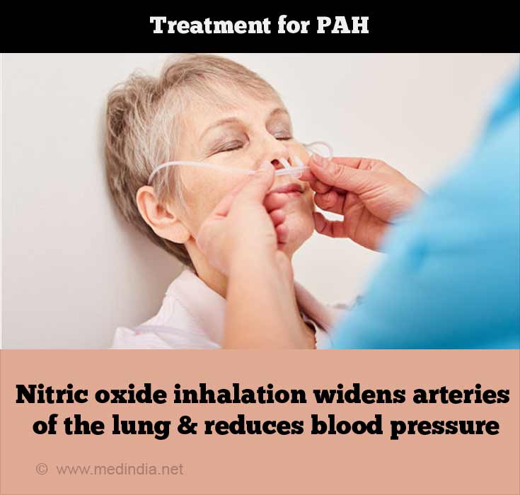 Treatment for PAH Treatment for PAH