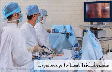 Treatment For Trichobezoars - laparoscopy Treatment For Trichobezoars - laparoscopy
