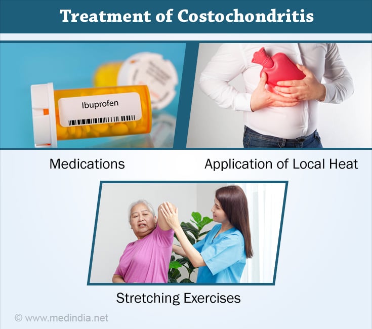 Treatment of Costochondritis