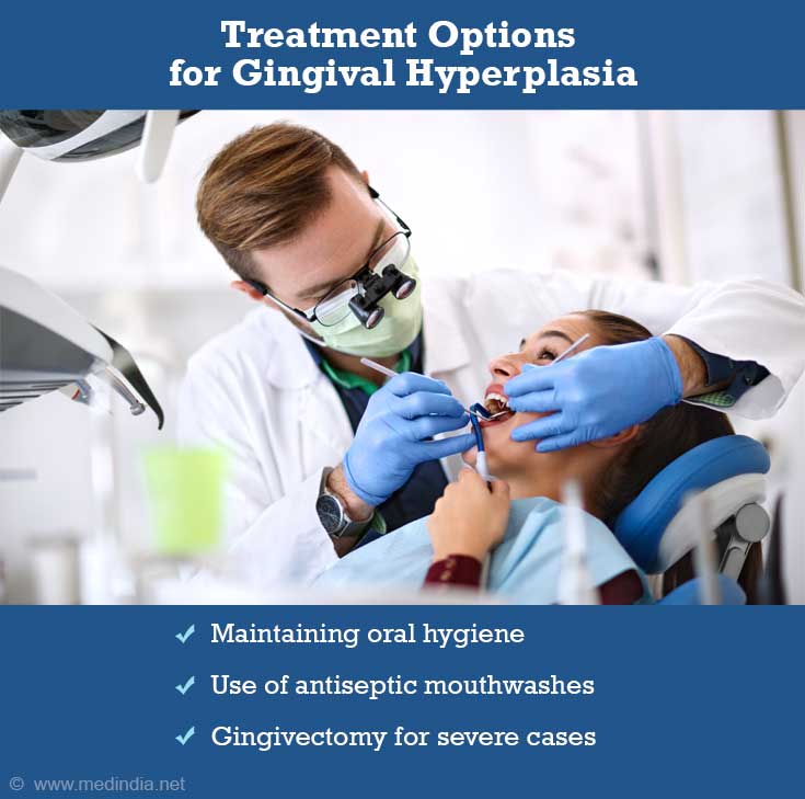 Treatment Options for Gingival Hyperplasia Treatment Options for Gingival Hyperplasia