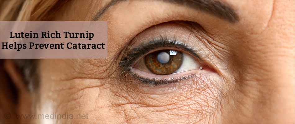 Lutein Rich Turnip Helps Prevent Cataract Lutein Rich Turnip Helps Prevent Cataract