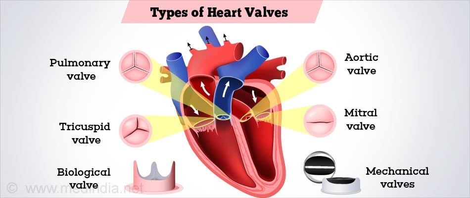 Heart valves