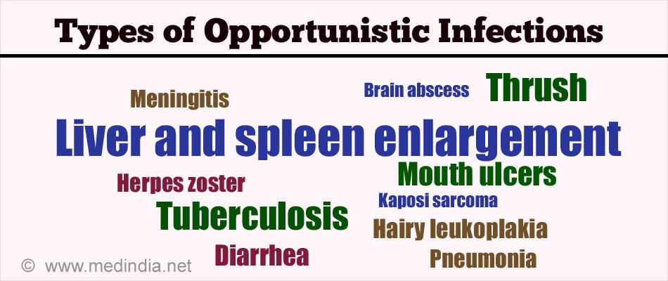 Opportunistic Infections - Causes, Symptoms, Diagnosis, Treatment &  Prevention