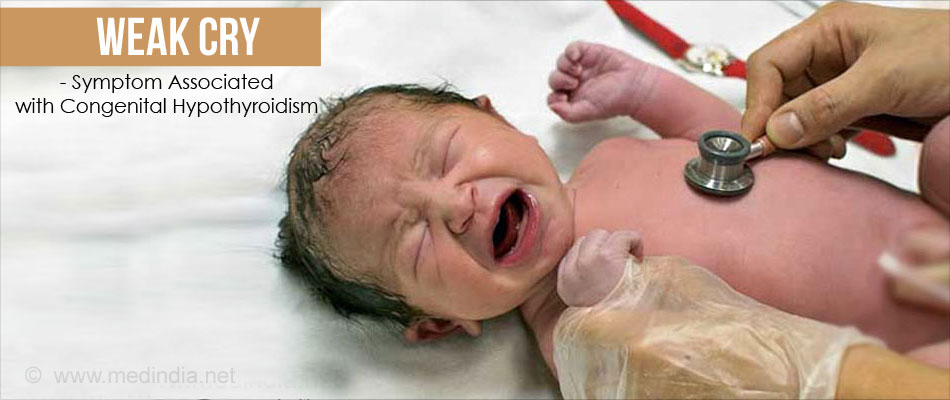 Weak Cry Symptom of Congenital Hypothyroidism Weak Cry Symptom of Congenital Hypothyroidism