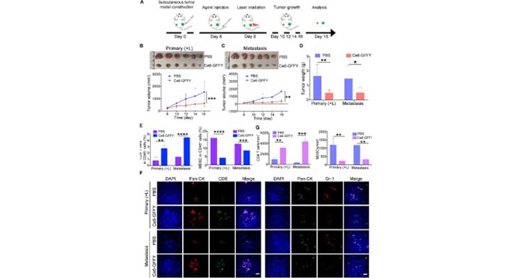 Ce6-GFFY activates anti-tumor immunity and suppresses metastatic tumor growth