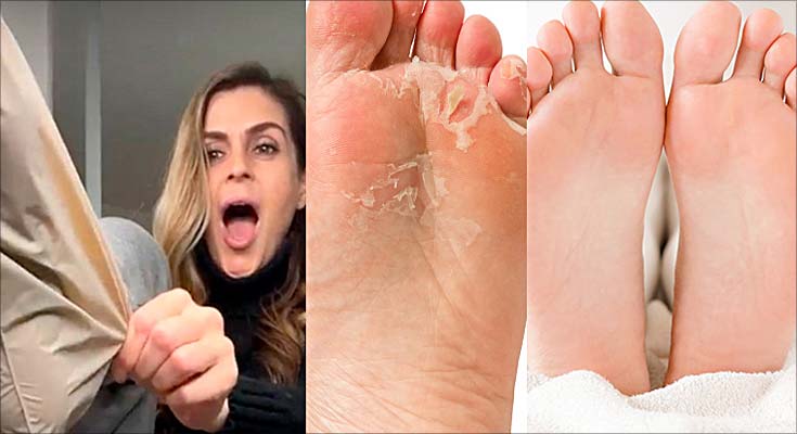 Feets Foot Peel Mask