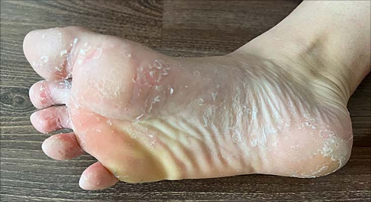 Feets Foot Peel Mask