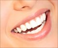 Quiz on Dental Care Quiz on Dental Care