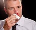 Quiz on Nosebleed