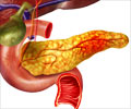 Quiz on Pancreatic Cancer