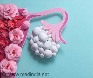 PCOD Myths Busted! How Smart Are You About Diet & Lifestyle?