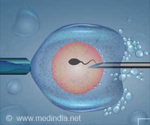 Quiz on Invitro Fertilization